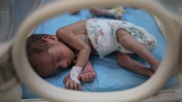 DSÖ: Gazze’de çocuklar açlıktan ölüyor